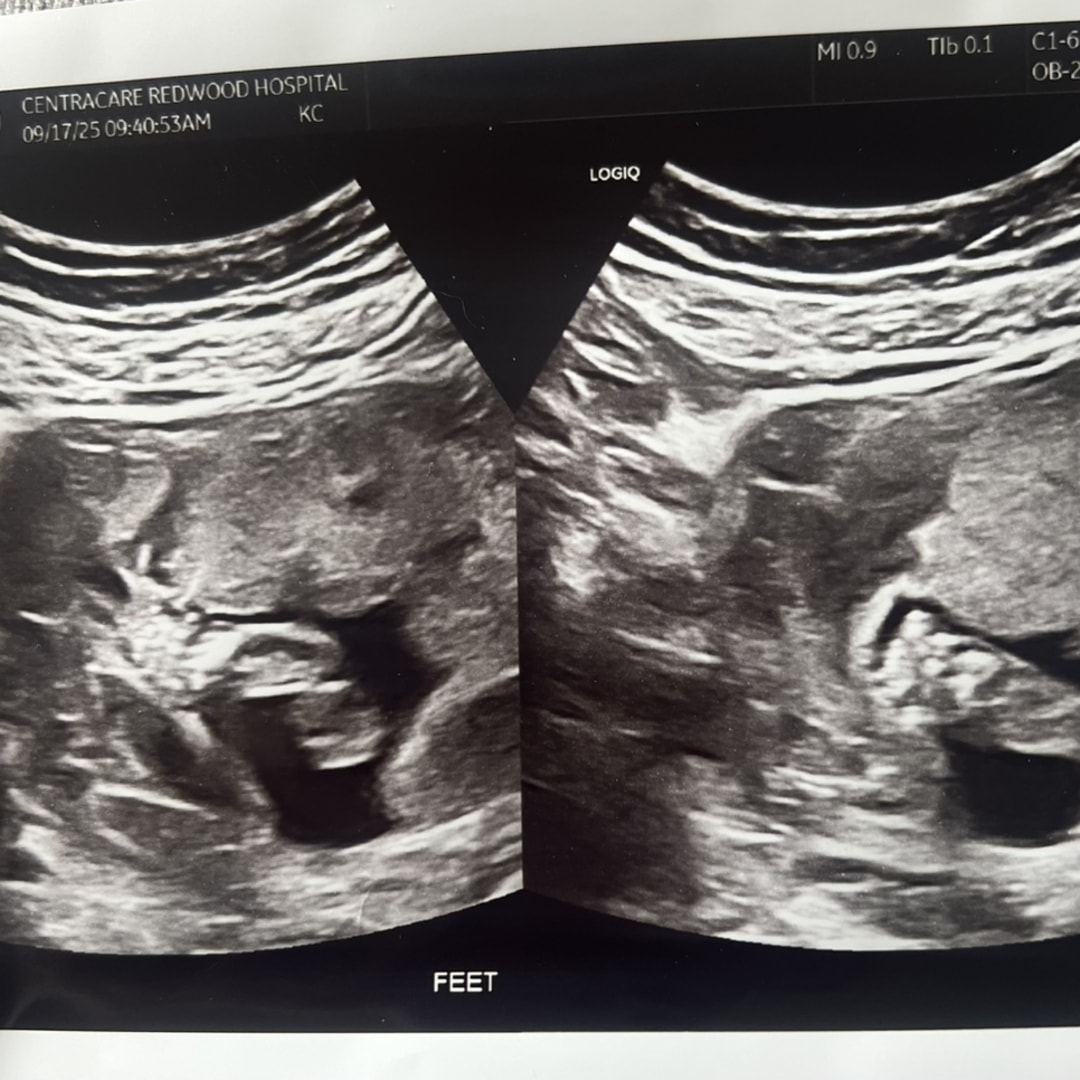 Photo shared by Lilly for their Babylist baby registry.
