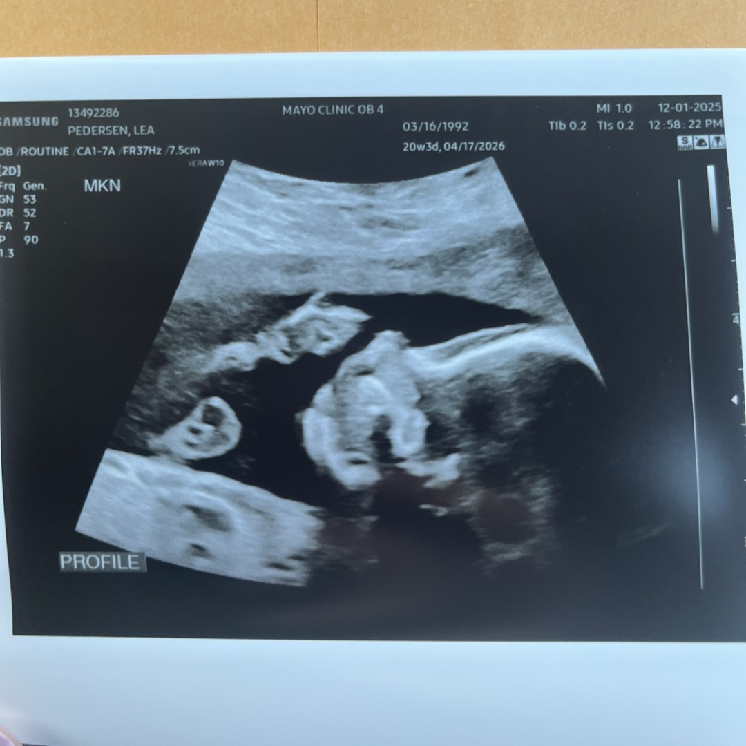 Photo shared by Lea for their Babylist baby registry.