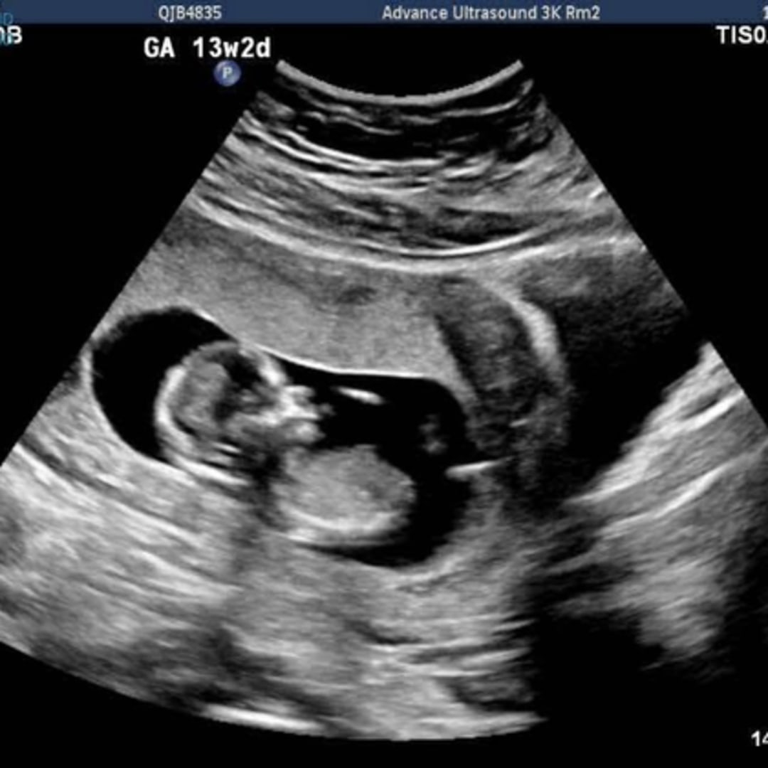 Photo shared by Ueiti for their Babylist baby registry.