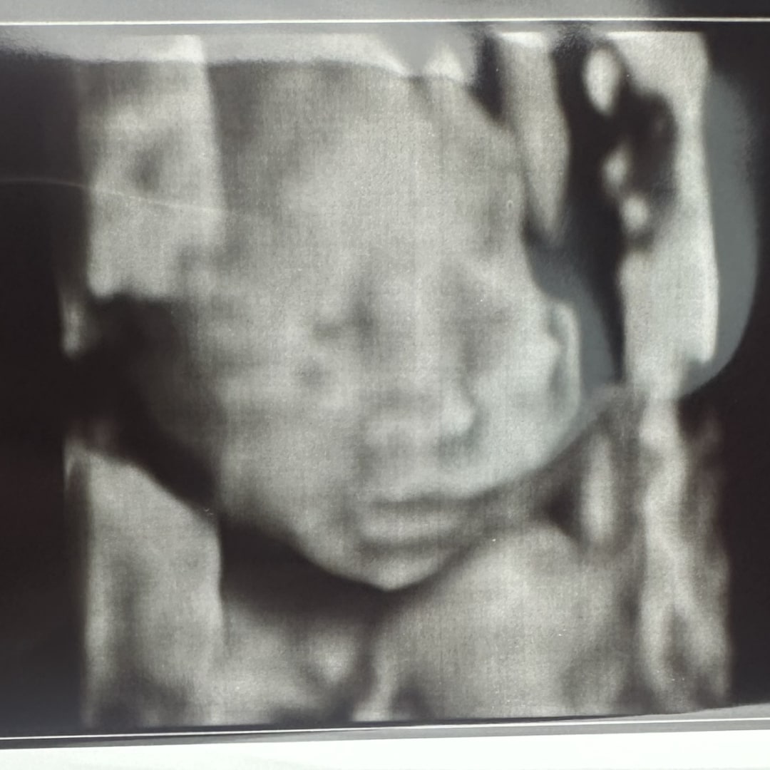 Photo shared by Madelyn for their Babylist baby registry.