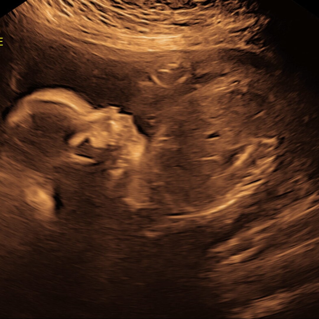 Photo shared by Hannah for their Babylist baby registry.