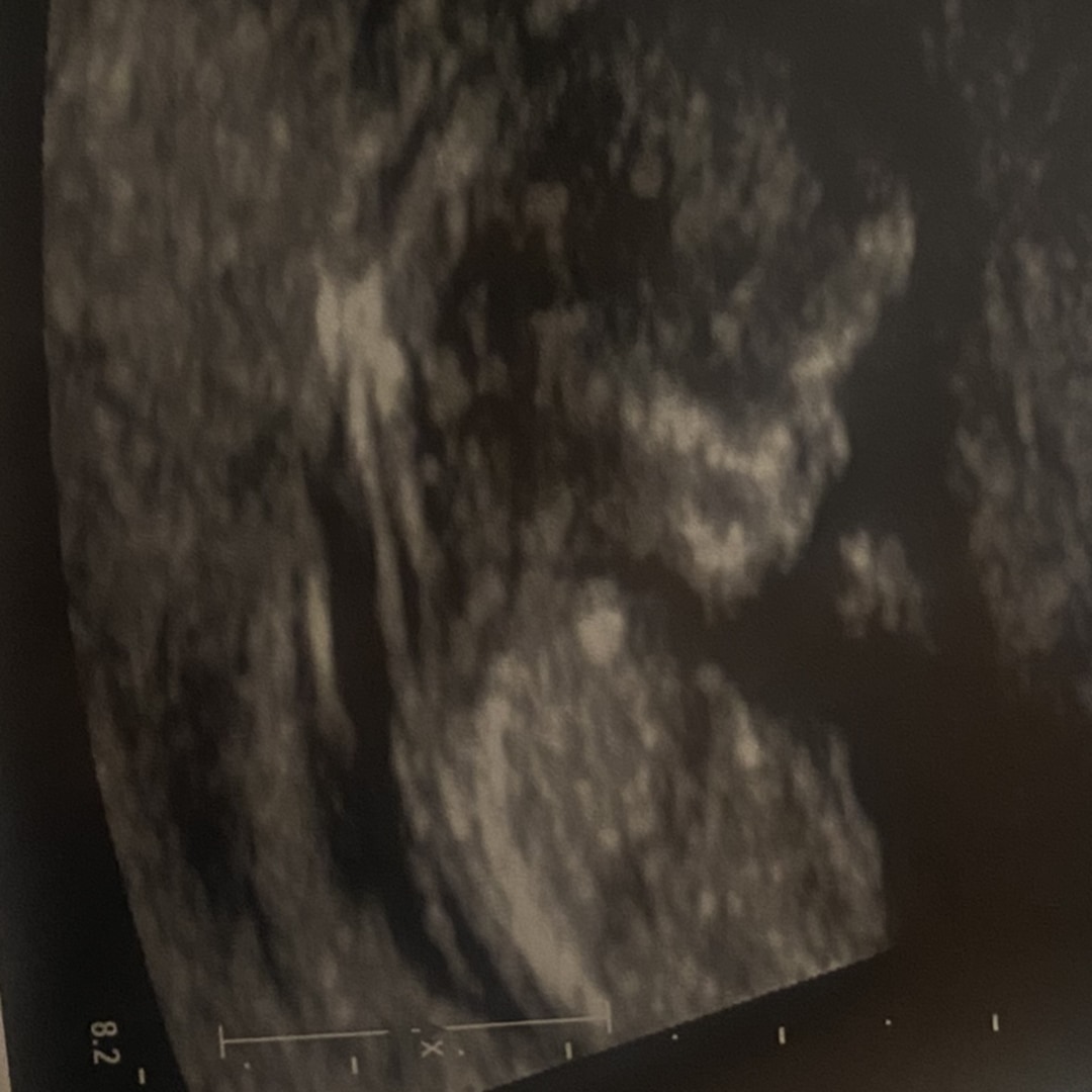 Photo shared by Maria for their Babylist baby registry.