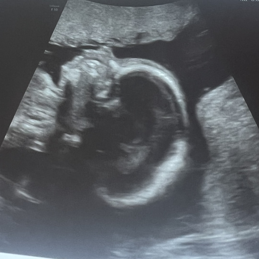 Photo shared by Megan for their Babylist baby registry.