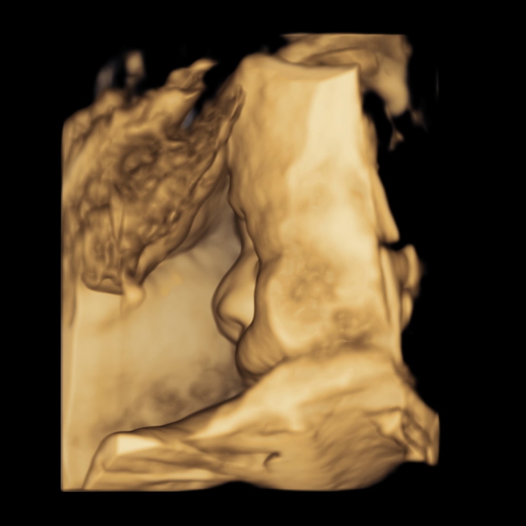 Photo shared by Norimar for their Babylist baby registry.