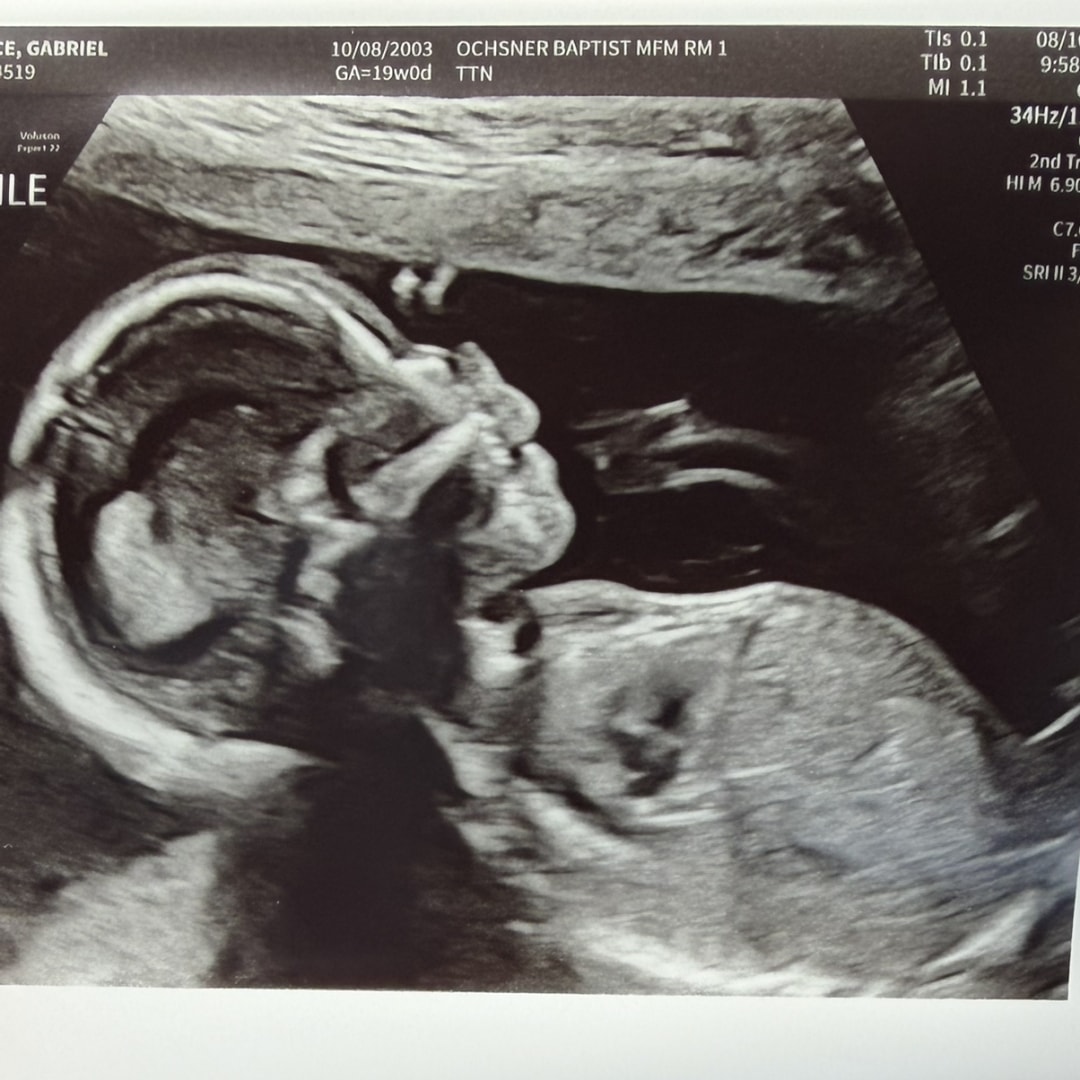 Photo shared by Gabriel for their Babylist baby registry.