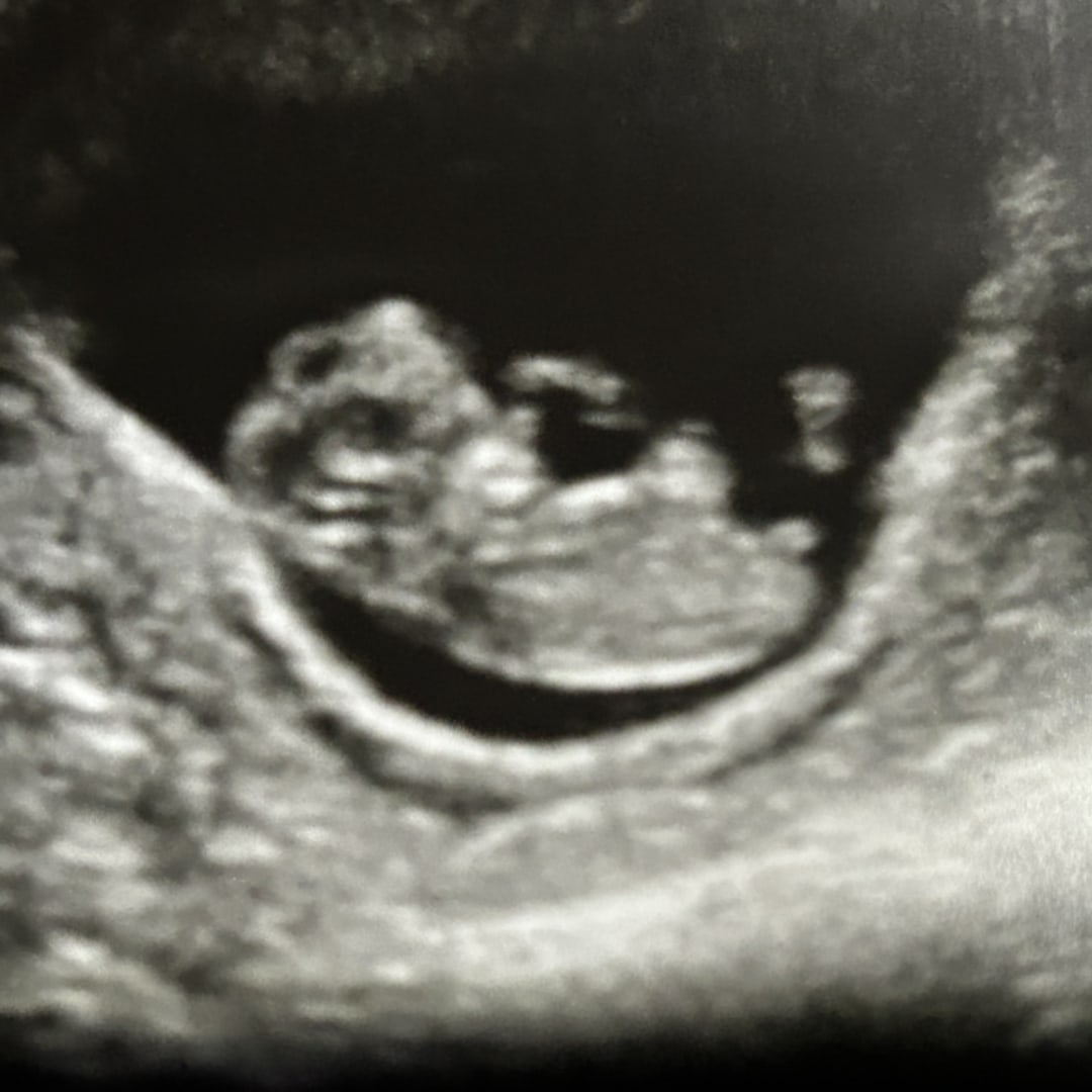 Photo shared by Jessica for their Babylist baby registry.