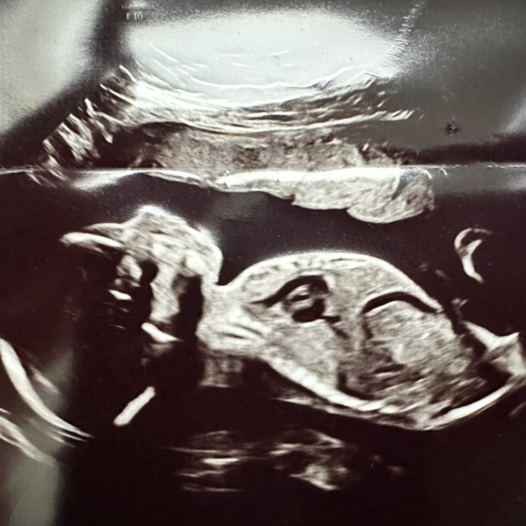 Photo shared by Julia for their Babylist baby registry.