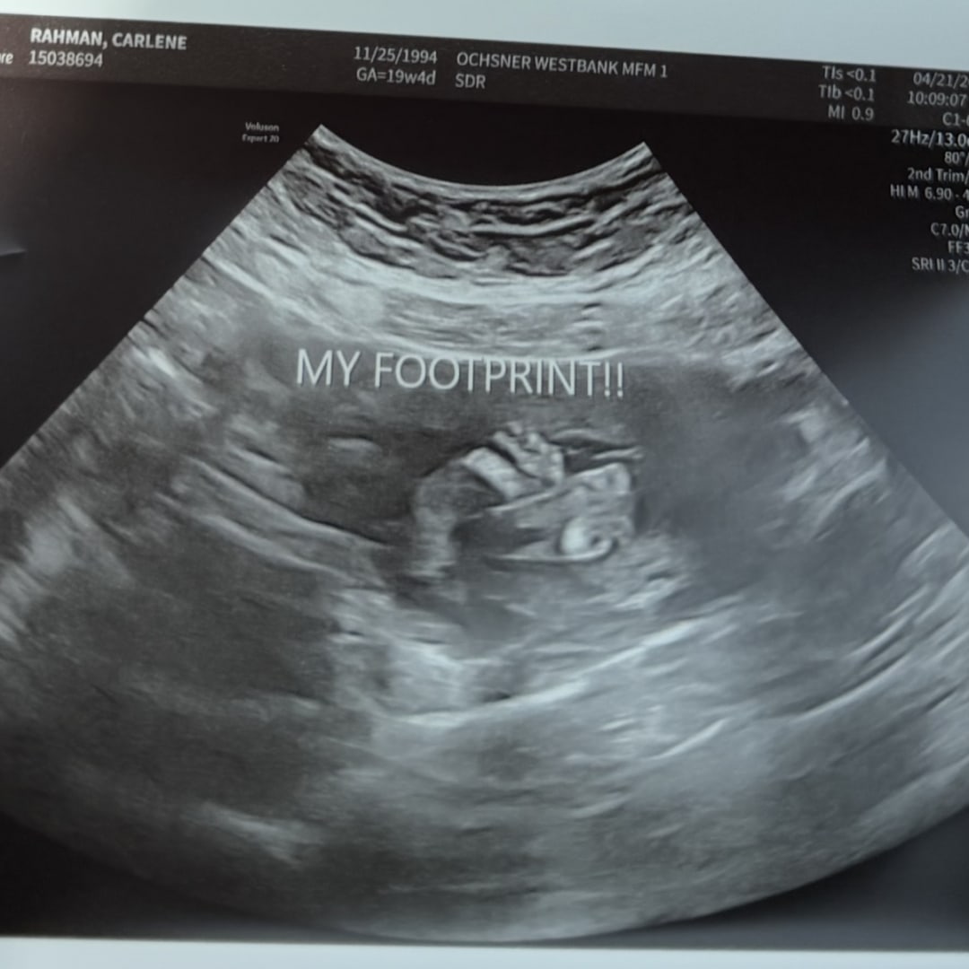 Photo shared by Carlene for their Babylist baby registry.