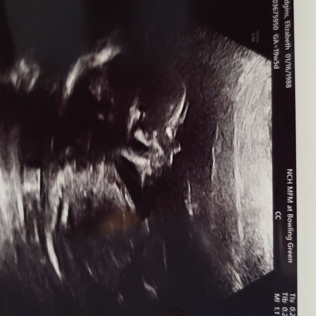 Photo shared by Christopher for their Babylist baby registry.