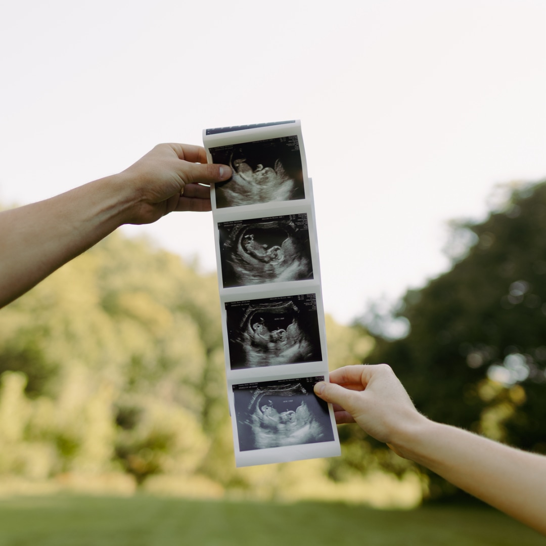 Photo shared by Anna and Will for their Babylist baby registry.