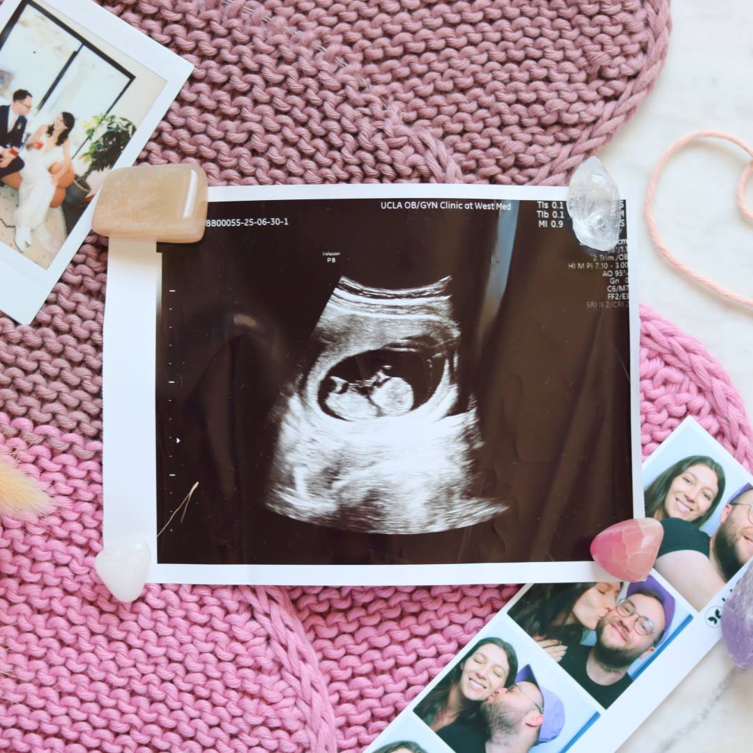 Photo shared by Emily for their Babylist baby registry.