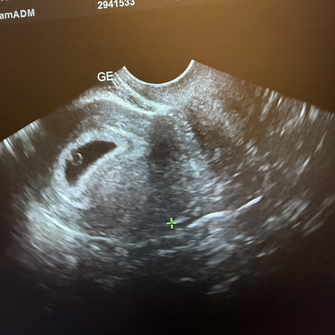 Photo shared by Sarah for their Babylist baby registry.