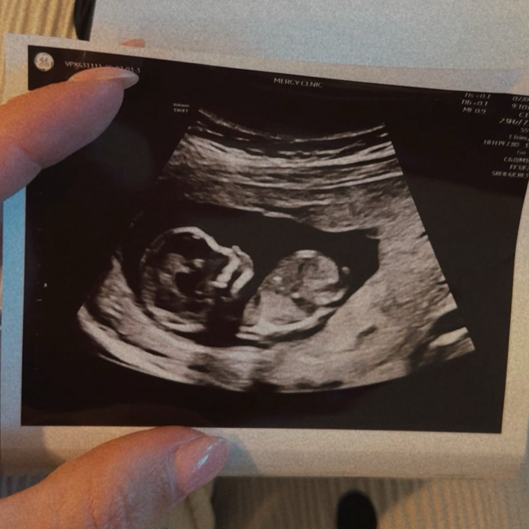 Photo shared by Ziara for their Babylist baby registry.