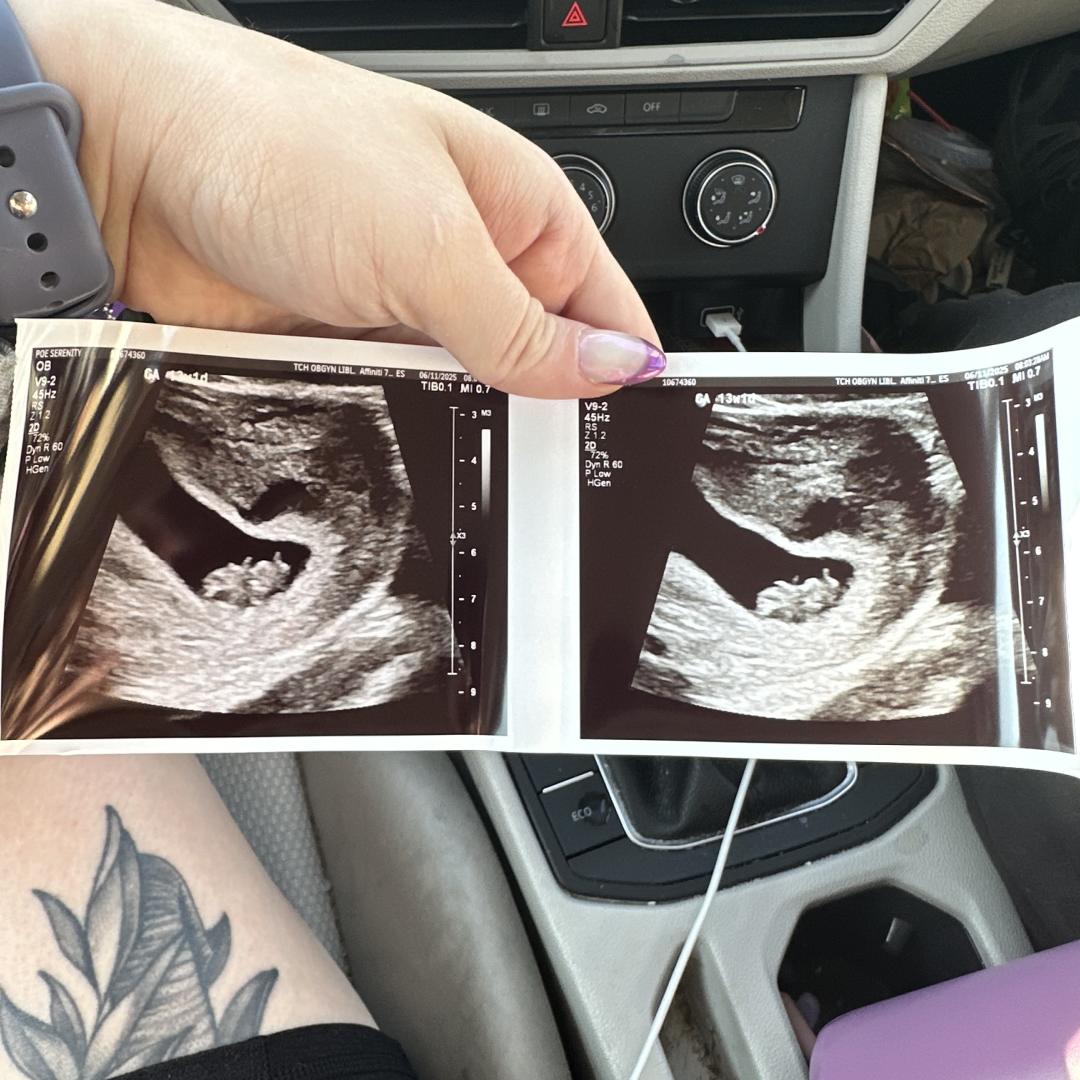 Photo shared by Serenity for their Babylist baby registry.