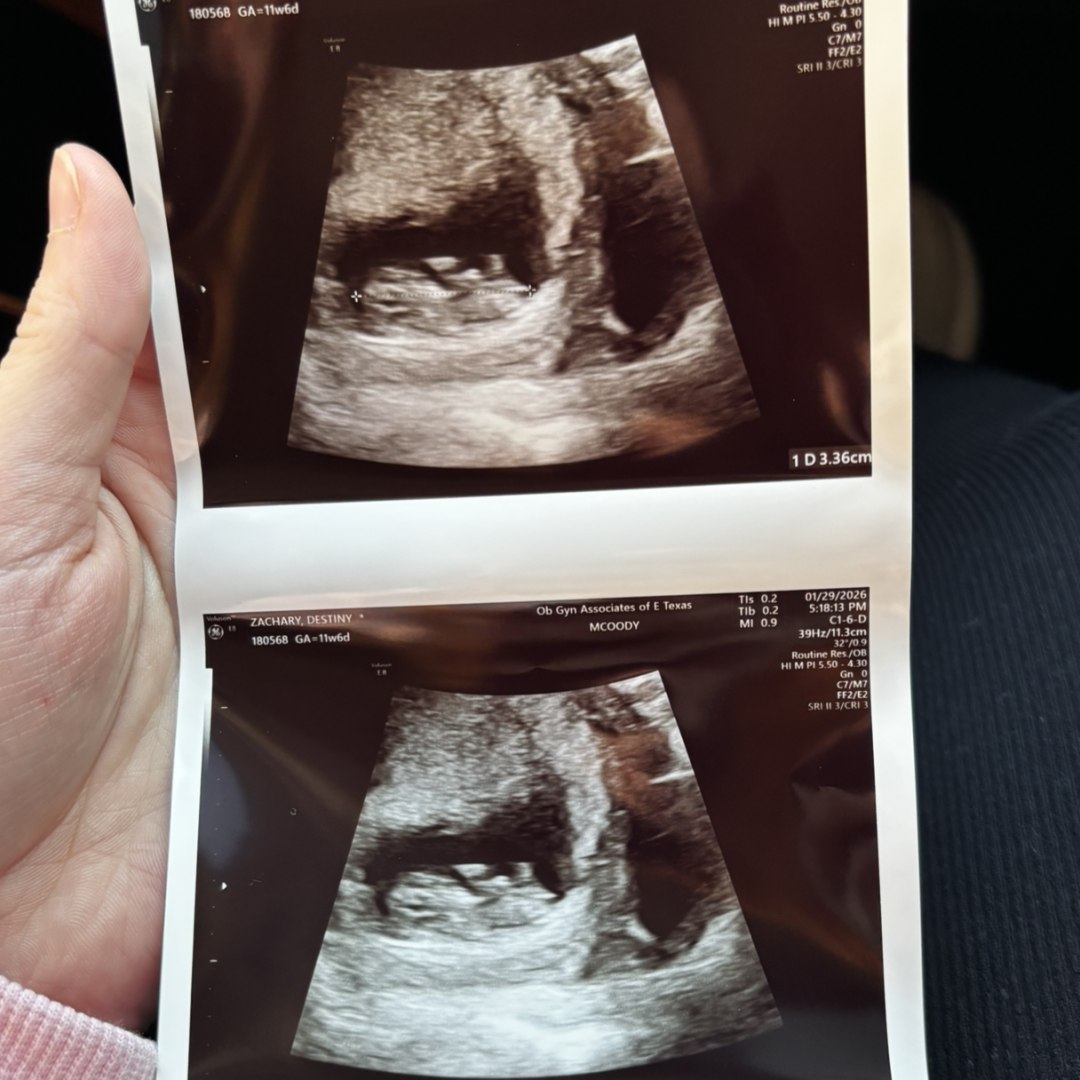 Photo shared by Destiny for their Babylist baby registry.