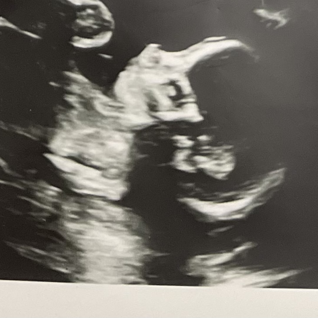 Photo shared by Chantalle for their Babylist baby registry.