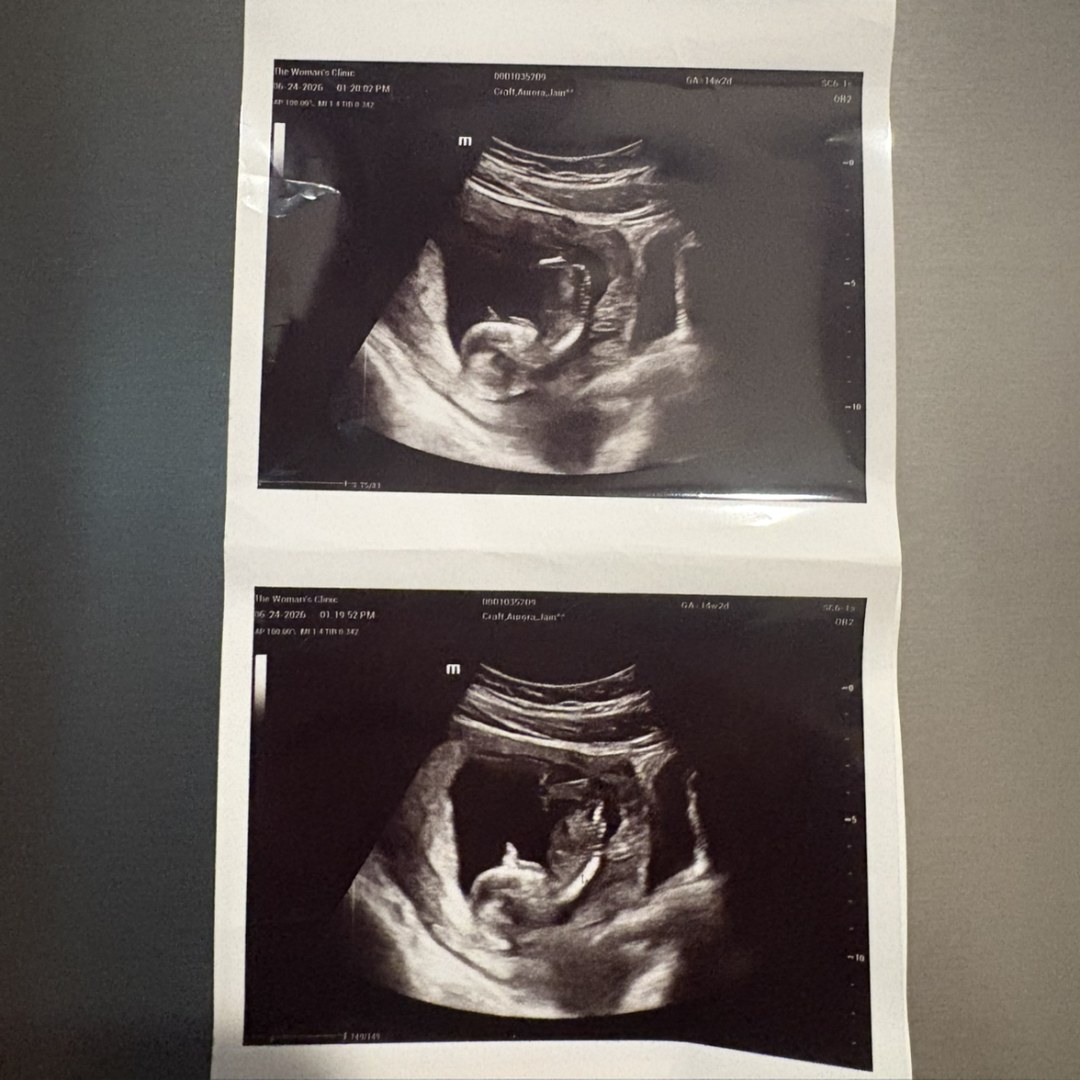 Photo shared by Aurora for their Babylist baby registry.