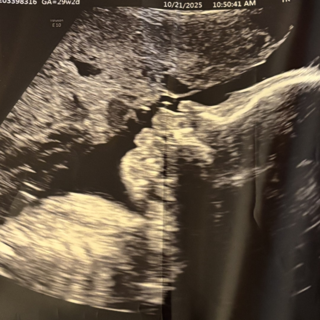 Photo shared by Christina for their Babylist baby registry.