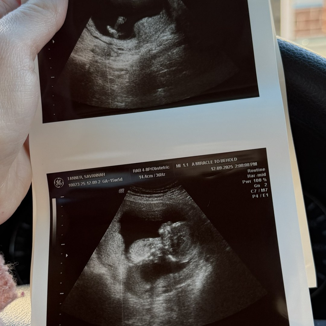 Photo shared by Savannah for their Babylist baby registry.
