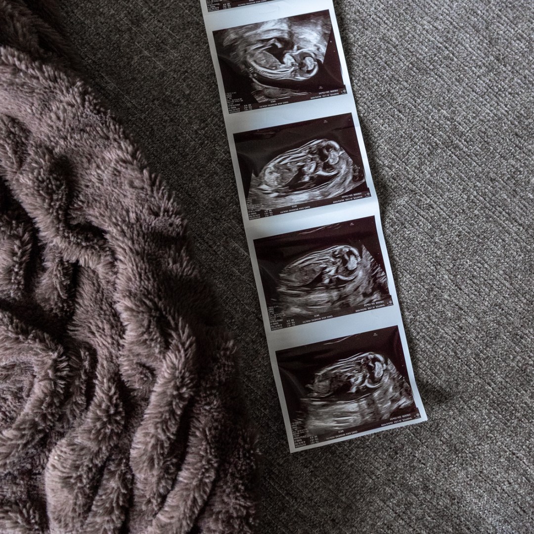 Photo shared by Jalisa for their Babylist baby registry.