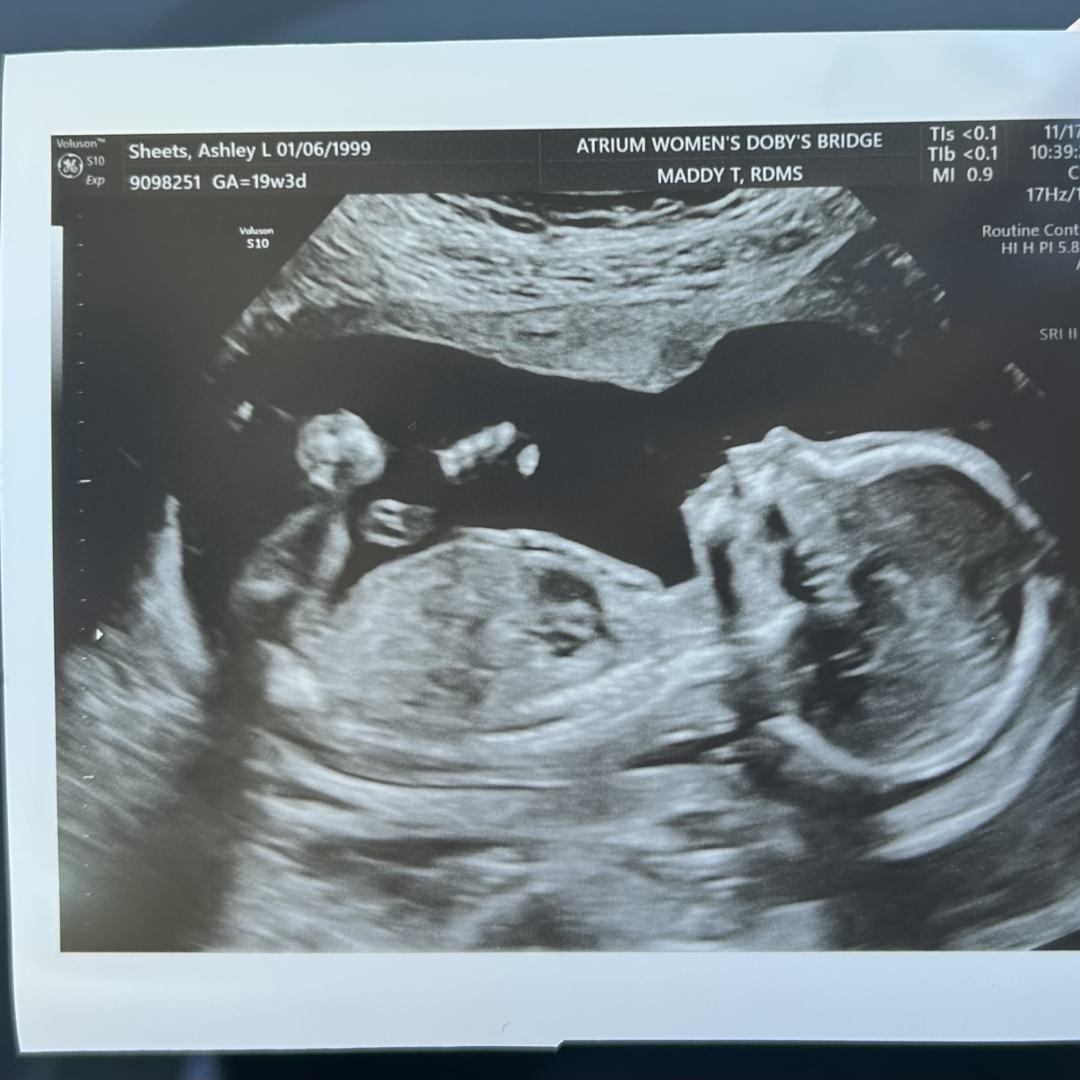 Photo shared by Ashley for their Babylist baby registry.