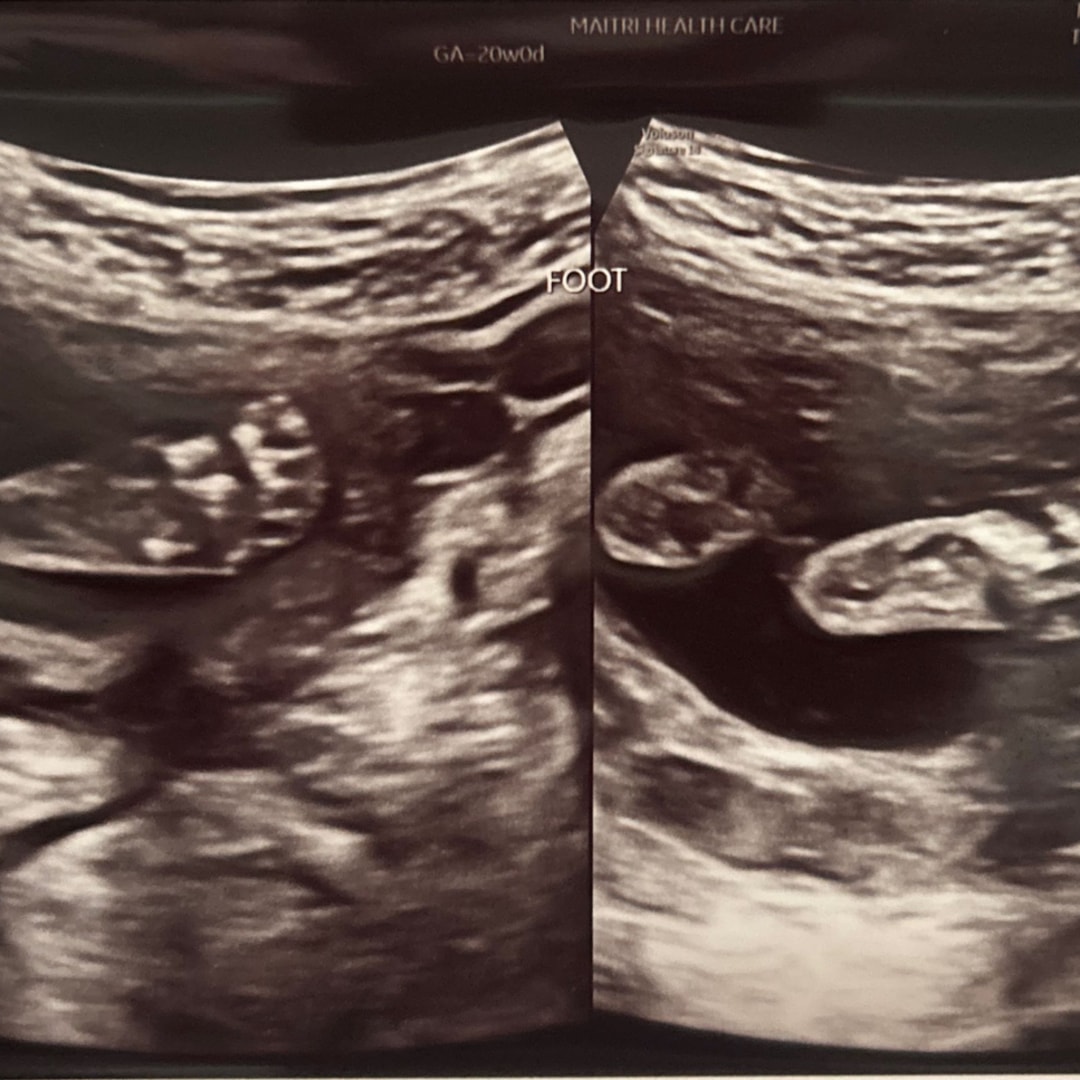 Photo shared by Ariel for their Babylist baby registry.