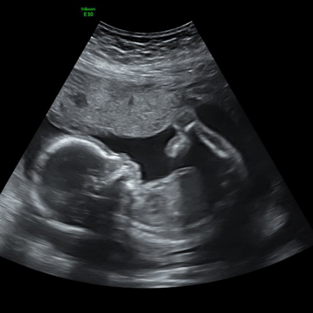 Photo shared by Joni for their Babylist baby registry.
