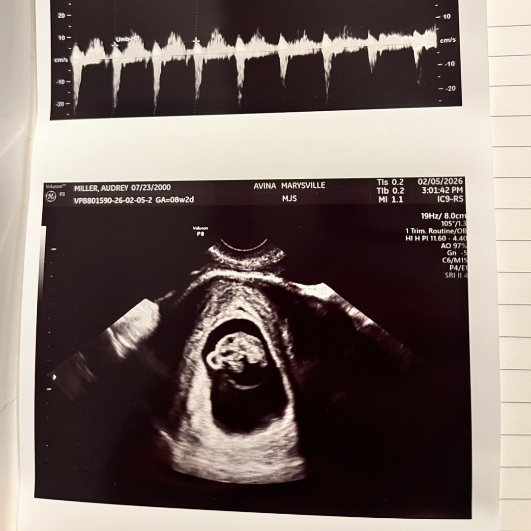 Photo shared by Audrey for their Babylist baby registry.