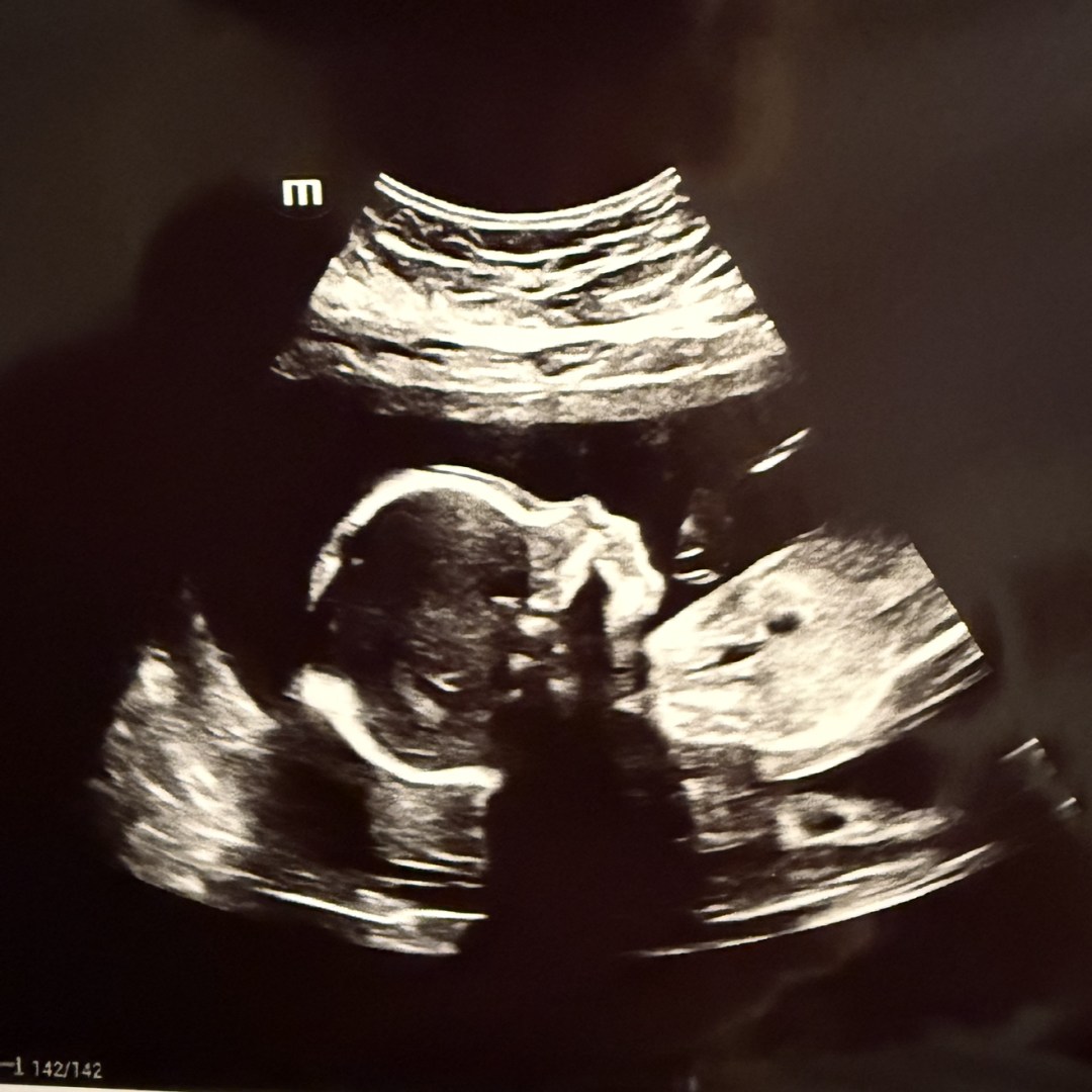 Photo shared by Jerilee for their Babylist baby registry.