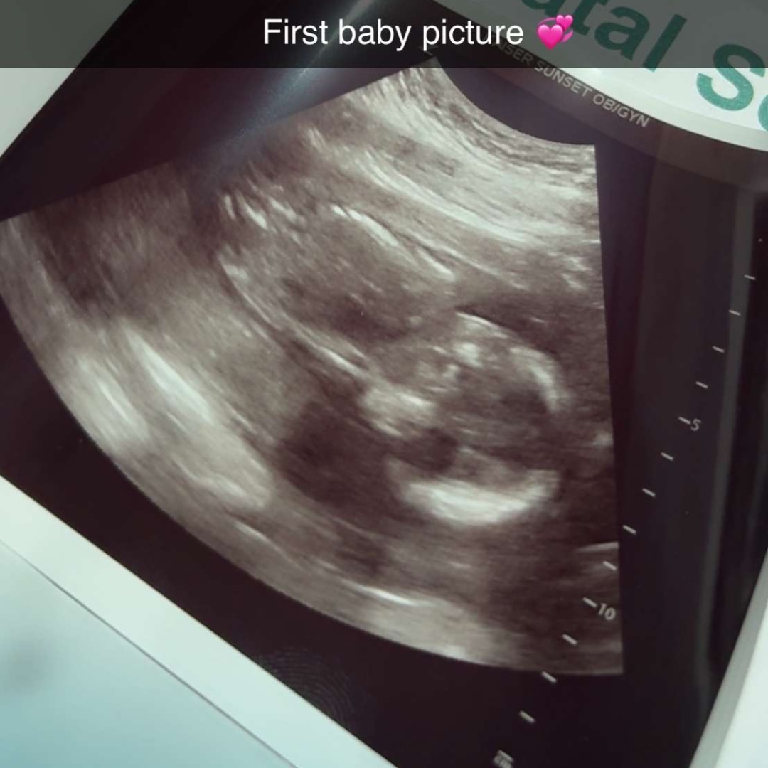 Photo shared by Asaeily for their Babylist baby registry.