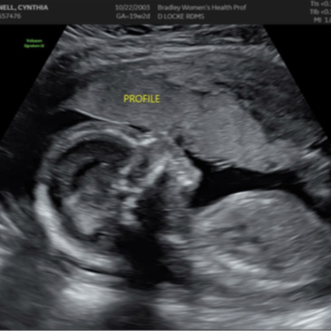 Photo shared by Cynthia for their Babylist baby registry.