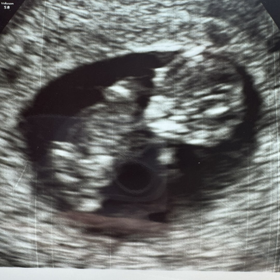 Photo shared by Rachael for their Babylist baby registry.