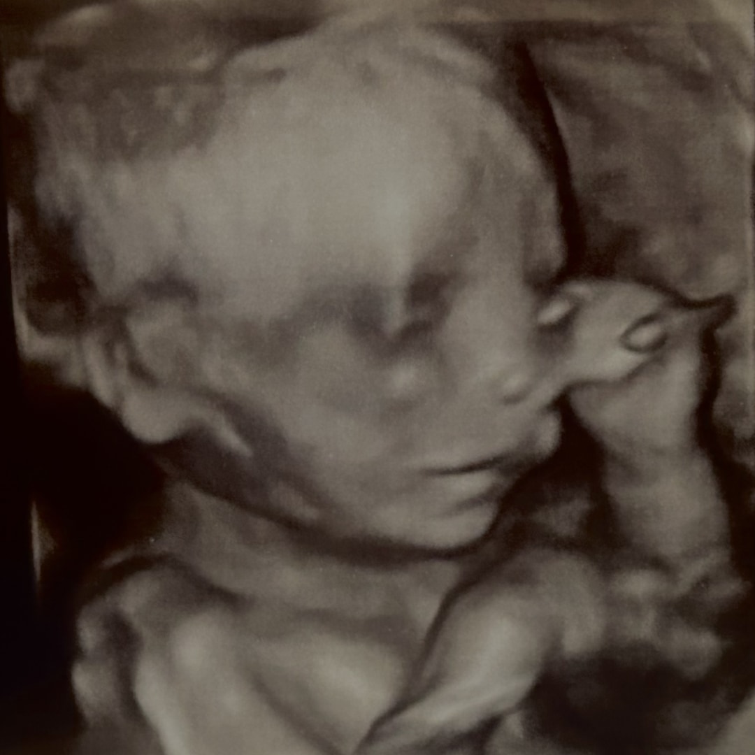 Photo shared by Katelyn for their Babylist baby registry.