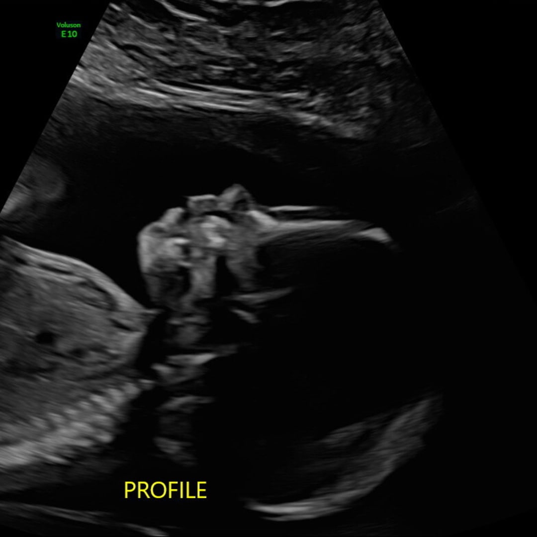 Photo shared by Whitney for their Babylist baby registry.