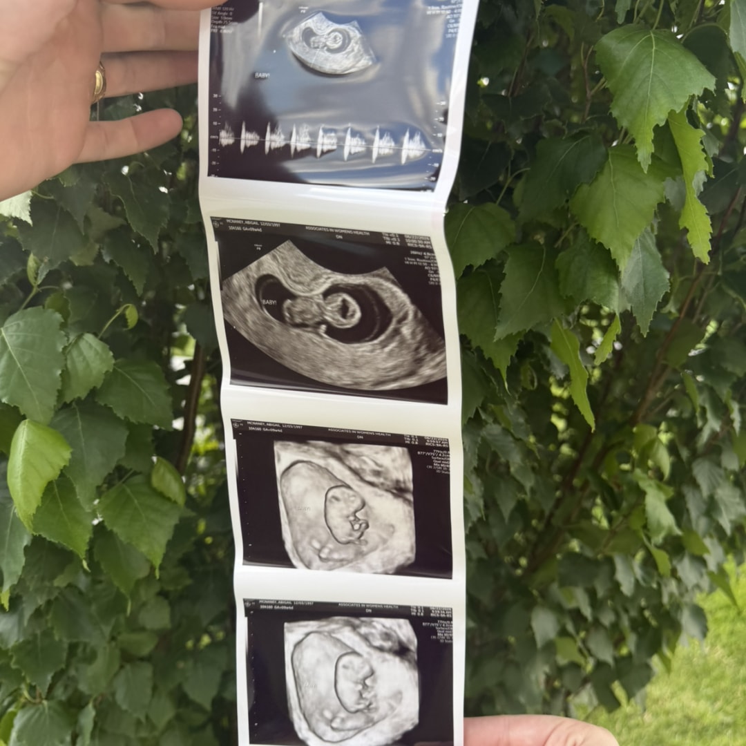 Photo shared by Abigail for their Babylist baby registry.