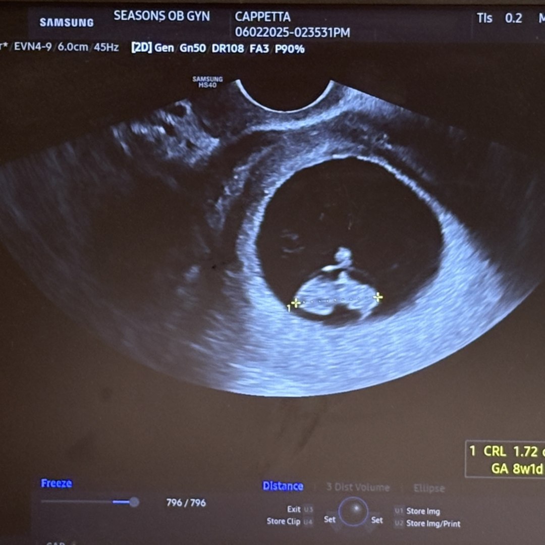 Photo shared by Jesseca for their Babylist baby registry.