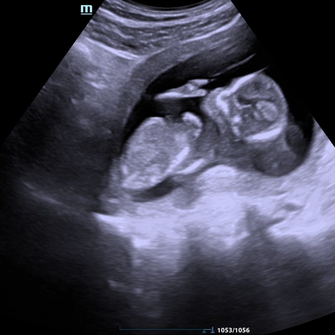 Photo shared by Madison for their Babylist baby registry.