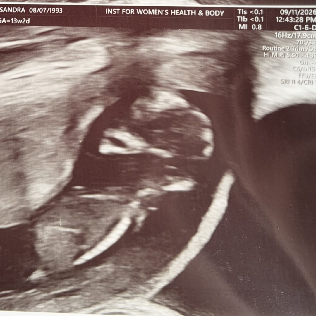 Photo shared by Kassandra for their Babylist baby registry.