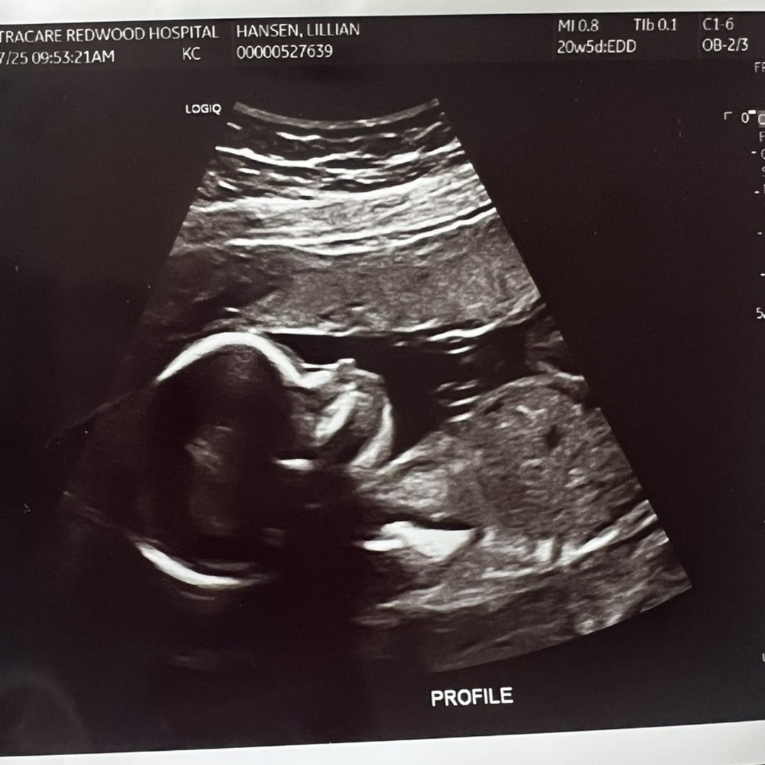 Photo shared by Lilly for their Babylist baby registry.