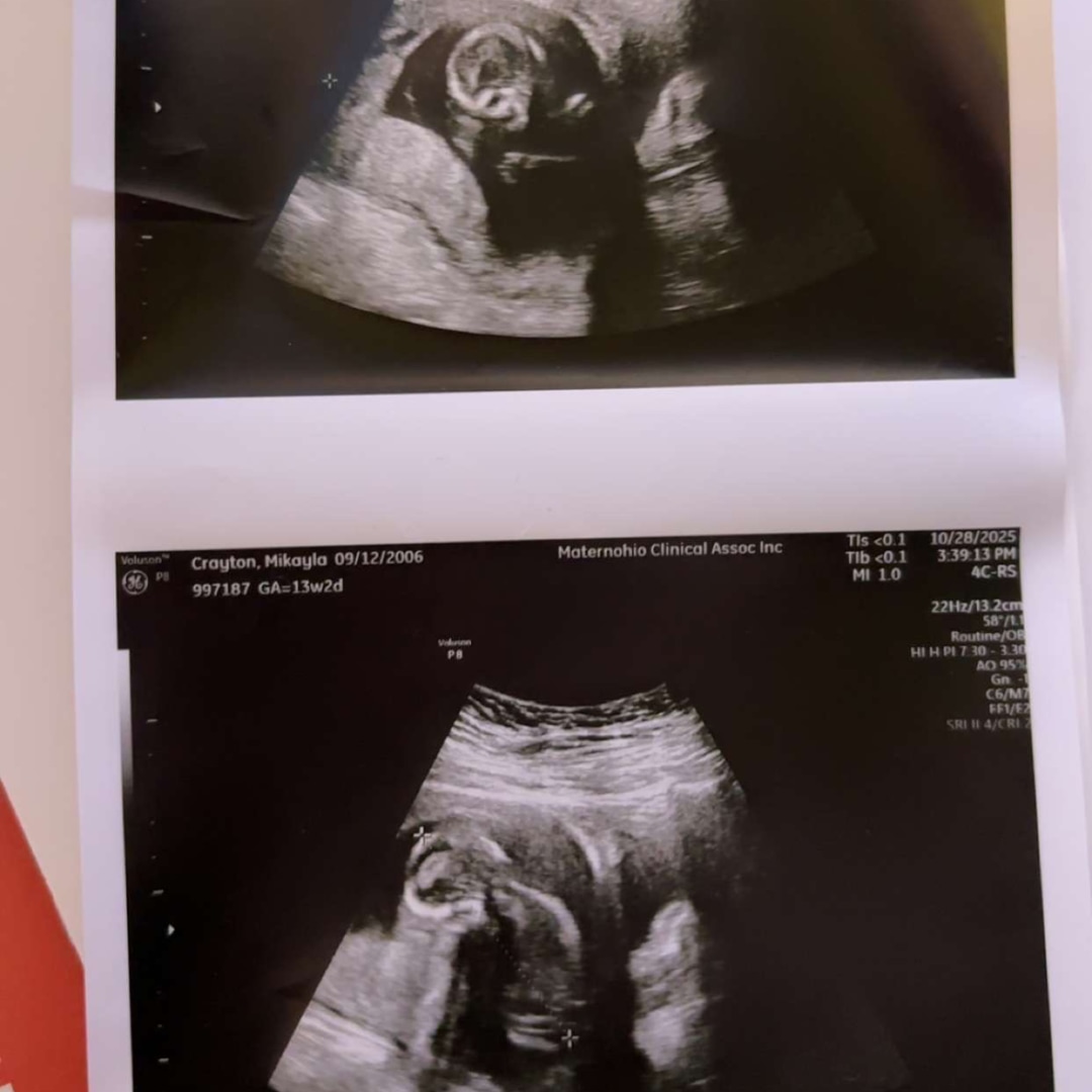 Photo shared by Mikayla for their Babylist baby registry.