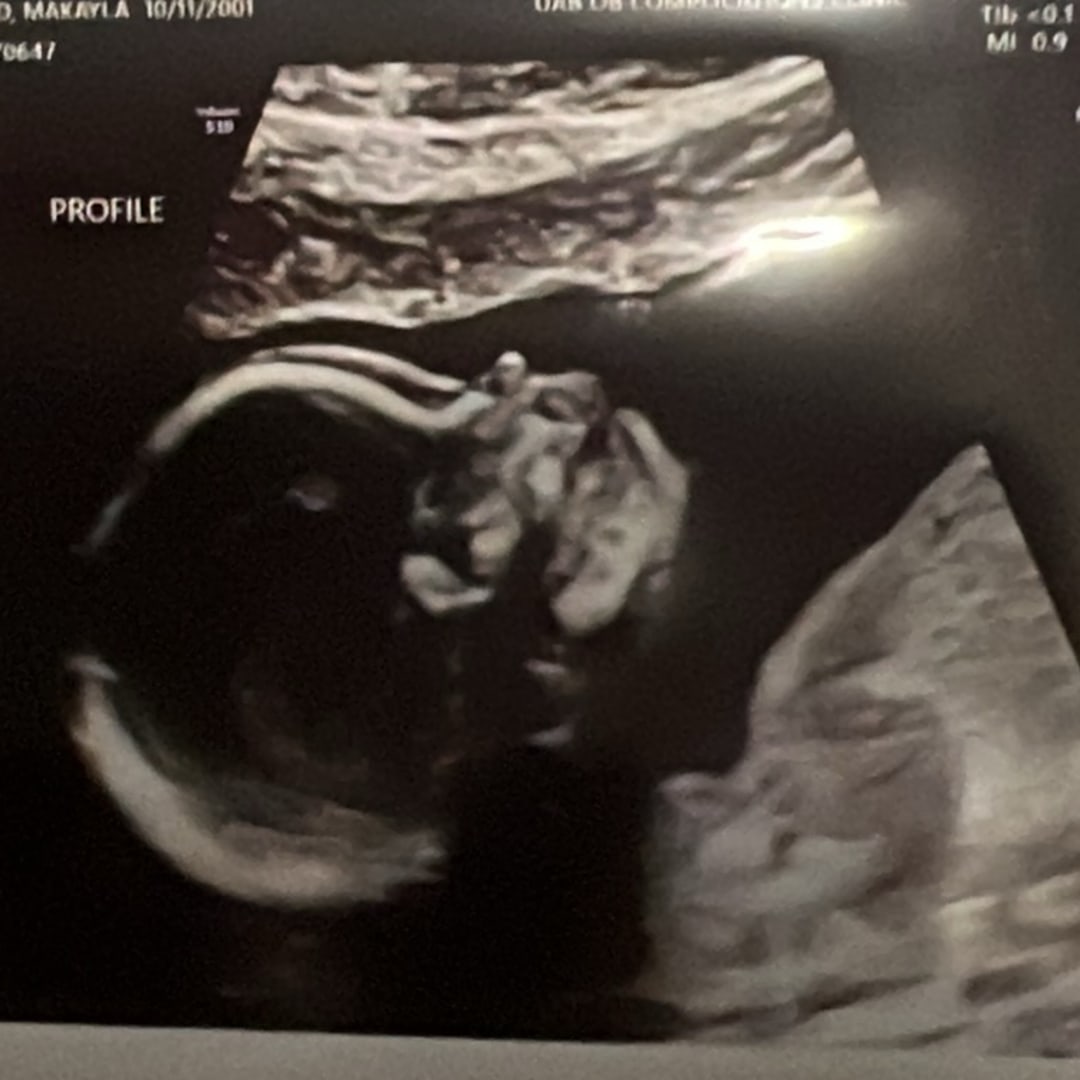 Photo shared by Kayla for their Babylist baby registry.