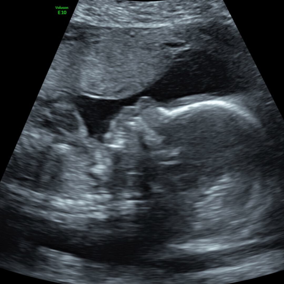 Photo shared by Addie for their Babylist baby registry.