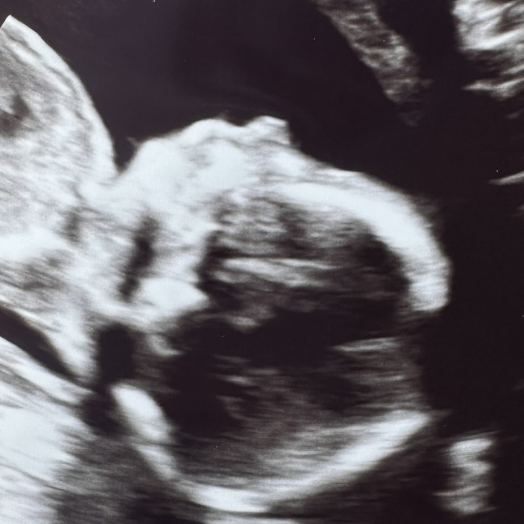 Photo shared by Skye for their Babylist baby registry.