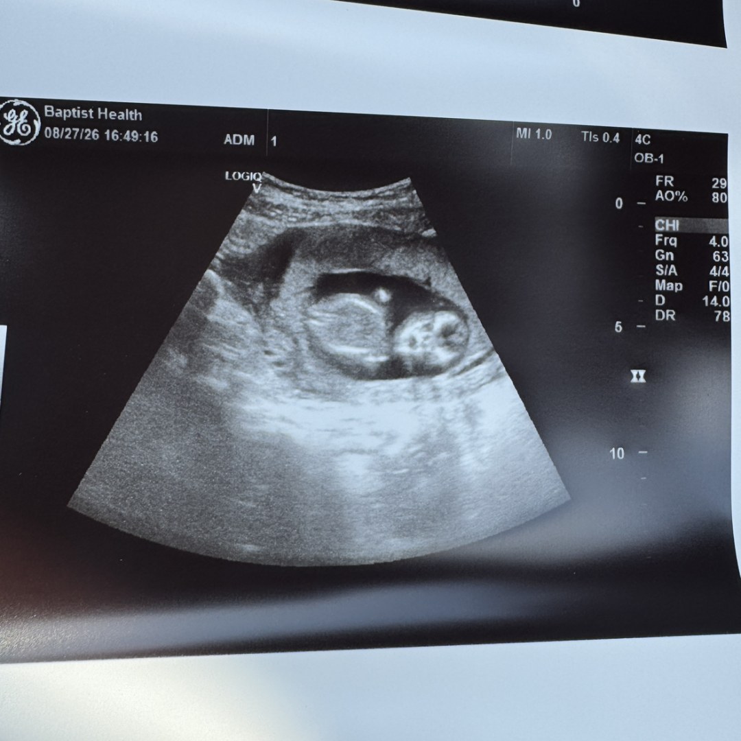 Photo shared by Ashlee for their Babylist baby registry.