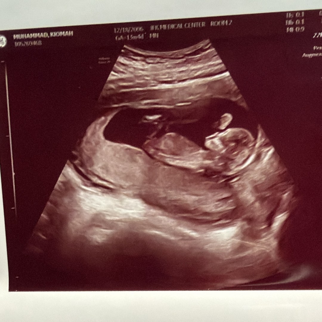 Photo shared by Kiomah for their Babylist baby registry.