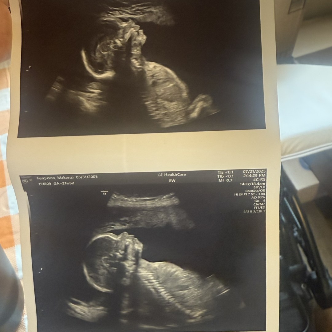 Photo shared by Kenzi for their Babylist baby registry.