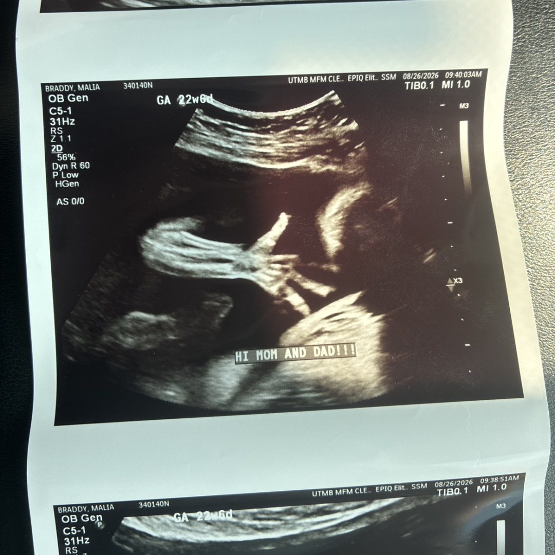 Photo shared by Malia B & for their Babylist baby registry.