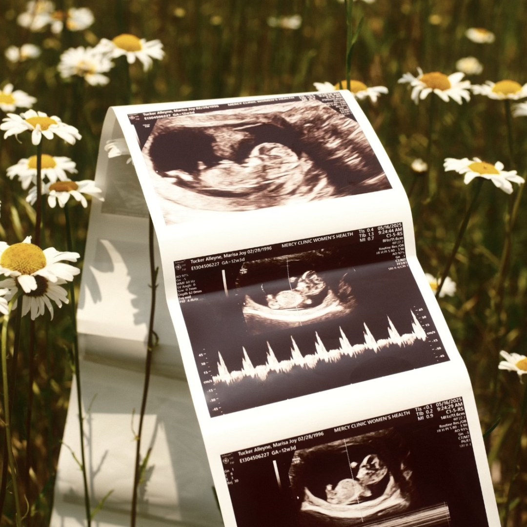 Photo shared by Marisa for their Babylist baby registry.