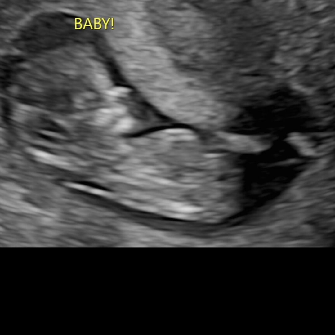 Photo shared by Briana for their Babylist baby registry.