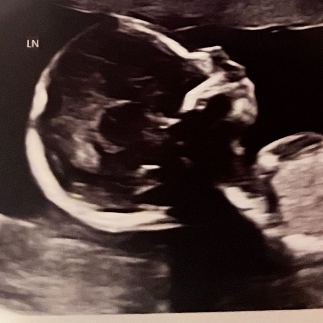 Photo shared by Tarcia for their Babylist baby registry.